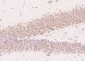 TRIP1 Polyclonal Antibody